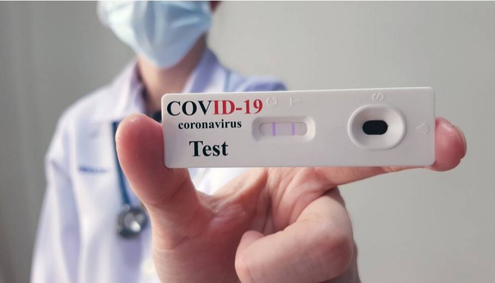 Crece la demanda de los test de Covid que se consiguen en farmacias por unos $1600